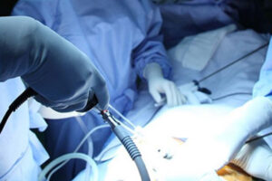 Bariatrik Cerrahi Çeşitleri 